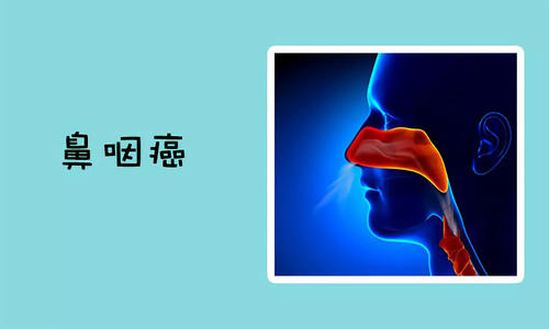 鼻咽癌会引起哪些并发症呢