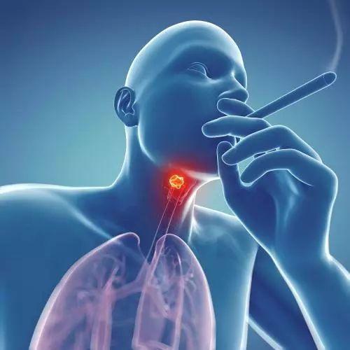 杭州老中医告诉你：引发喉癌的因素有哪几个