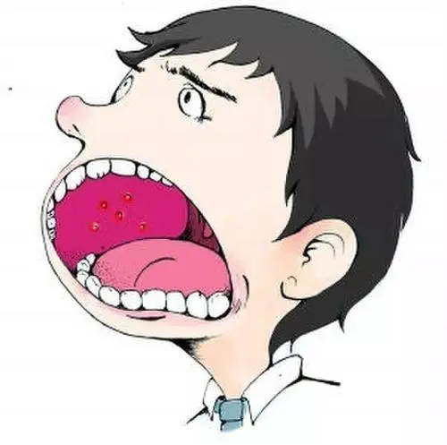 杭州御和堂中医为你解答：口腔癌的常见病因是什么？
